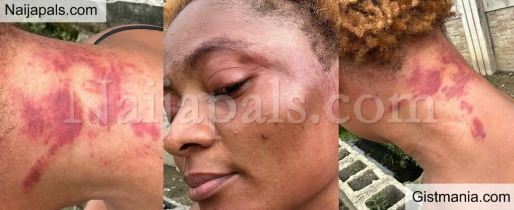 injured woman injured woman